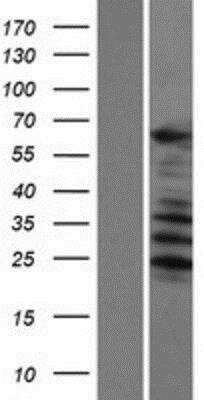 Western Blot: SARG Overexpression Lysate [NBP2-06372]