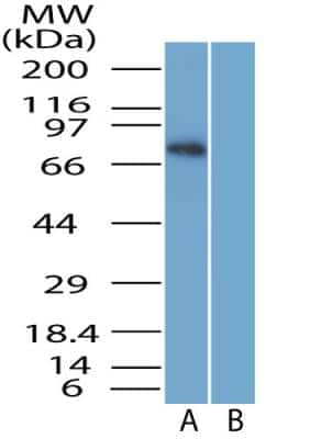 Western Blot: SARM1 AntibodyBSA Free [NBP2-29625]