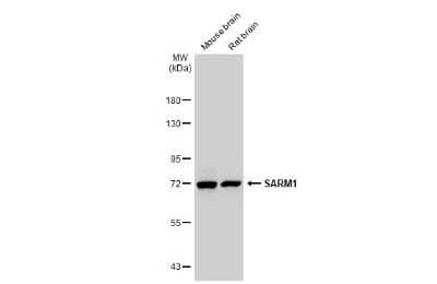 Western Blot: SARM1 Antibody (HL1066) [NBP3-13707]