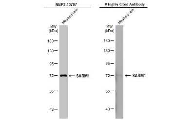 Western Blot: SARM1 Antibody (HL1066) [NBP3-13707]