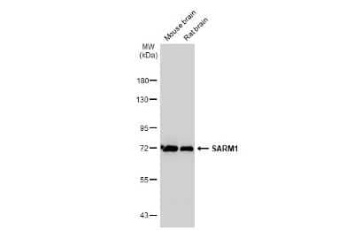 Western Blot: SARM1 Antibody (HL1070) [NBP3-13710]