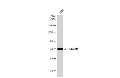 Western Blot: SARM1 Antibody (HL1070) [NBP3-13710]