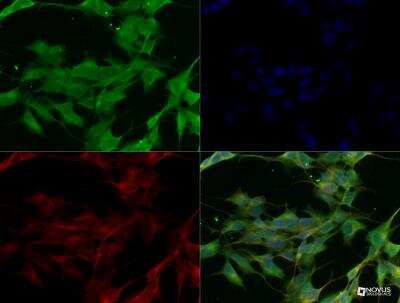 Immunocytochemistry/ Immunofluorescence: SARM1 Antibody - BSA Free [NBP2-29625]
