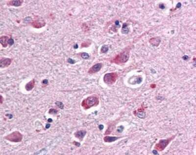 Immunohistochemistry-Paraffin: SARM1 Antibody (Sarmy-1) - BSA Free [NBP1-39550]