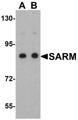 Western Blot: SARM1 AntibodyBSA Free [NBP1-77200]