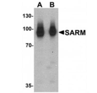 Western Blot: SARM1 AntibodyBSA Free [NBP2-41180]