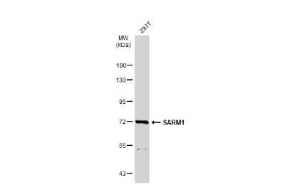 Western Blot: SARM1 Antibody [NBP3-13023]