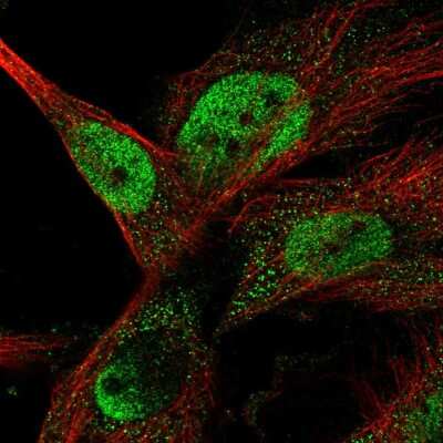 Immunocytochemistry/ Immunofluorescence: SARP Antibody [NBP1-92363]