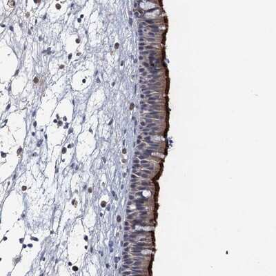 Immunohistochemistry-Paraffin: SARP Antibody [NBP1-92363]