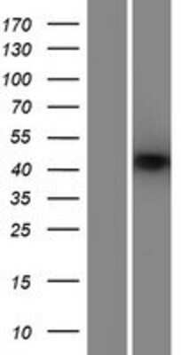 Western Blot: SARP Overexpression Lysate [NBP2-04805]