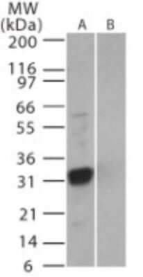 Western Blot: SARS 3b Antibody [NB100-56746]
