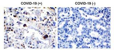 Immunohistochemistry-Paraffin: SARS-CoV-2 3CL Protease Antibody - BSA Free [NBP3-07062]