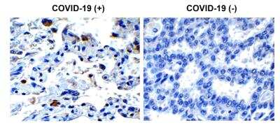 Immunohistochemistry: SARS-CoV-2 Envelope Antibody - BSA Free [NBP3-07060]