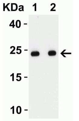 Western Blot: SARS-CoV-2 Envelope AntibodyBSA Free [NBP3-07060]