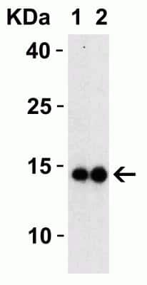 Western Blot: SARS-CoV-2 Membrane Protein AntibodyBSA Free [NBP3-07059]