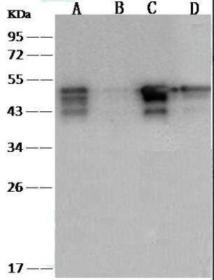 Western Blot: SARS-CoV-2 Nucleocapsid Antibody (004) [NBP3-12734]