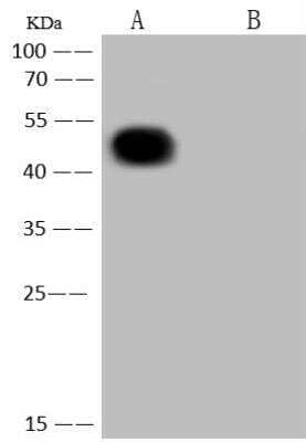 Western Blot: SARS-CoV-2 Nucleocapsid Antibody (004) [NBP3-12734]