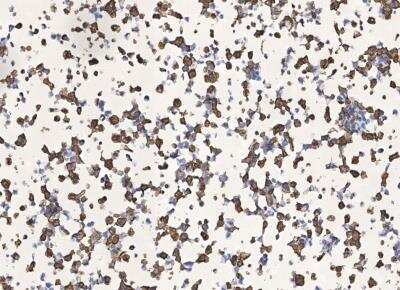 Immunohistochemistry-Paraffin: SARS-CoV-2 Nucleocapsid Antibody (019) [NBP3-12735]