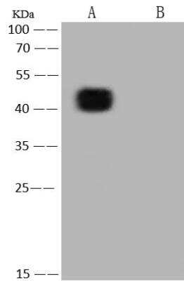 Western Blot: SARS-CoV-2 Nucleocapsid Antibody (019) [NBP3-12735]