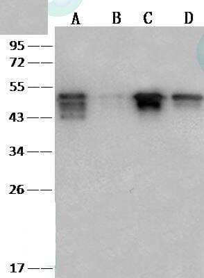 Western Blot: SARS-CoV-2 Nucleocapsid Antibody (040) [NBP3-12736]