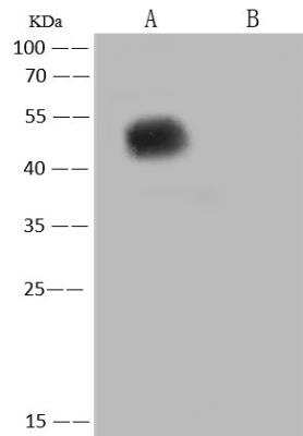 Western Blot: SARS-CoV-2 Nucleocapsid Antibody (040) [NBP3-12736]