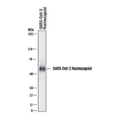 Western Blot: SARS-CoV-2 Nucleocapsid AntibodyBSA Free [NBP3-00510]