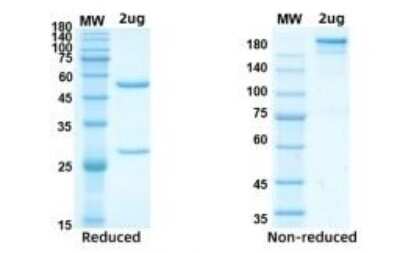 Western Blot: SARS-CoV-2 Nucleocapsid Antibody (D207)Azide and BSA Free [NBP3-07038]