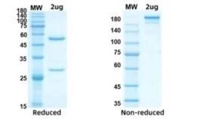 Western Blot: SARS-CoV-2 Nucleocapsid Antibody (G733)Azide and BSA Free [NBP3-07039]