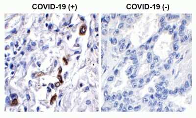 Immunohistochemistry-Paraffin: SARS-CoV-2 ORF3a Antibody - BSA Free [NBP3-11933]