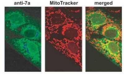 Immunocytochemistry/ Immunofluorescence: SARS-CoV-2 ORF7a Antibody (3C9) [NBP3-13521]