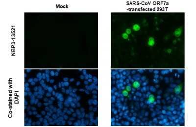 Immunocytochemistry/ Immunofluorescence: SARS-CoV-2 ORF7a Antibody (3C9) [NBP3-13521]