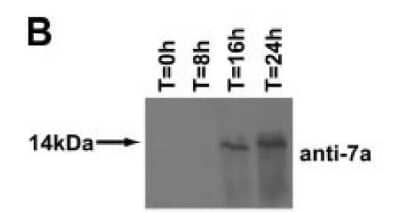Western Blot: SARS-CoV-2 ORF7a Antibody (3C9) [NBP3-13521]