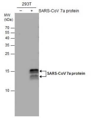 Western Blot: SARS-CoV-2 ORF7a Antibody (3C9) [NBP3-13521]