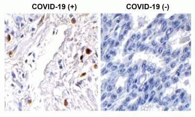 Immunohistochemistry-Paraffin: SARS-CoV-2 ORF7a Antibody - BSA Free [NBP3-11937]