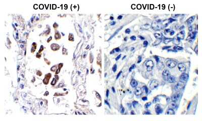 Immunohistochemistry-Paraffin: SARS-CoV-2 ORF8 Antibody - BSA Free [NBP3-11934]