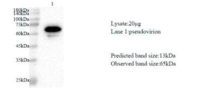 Western Blot: SARS-CoV-2 ORF8 AntibodyAzide and BSA Free [NBP3-07972]