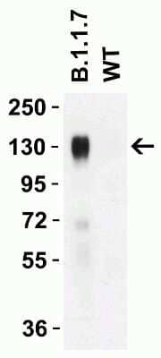 Western Blot: SARS-CoV-2 Spike AntibodyAlpha Variant, B.1.1.7, UKBSA Free [NBP3-11931]