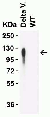 Western Blot: SARS-CoV-2 Spike AntibodyDelta Variant, B.1.617.2, IndiaBSA Free [NBP3-12853]