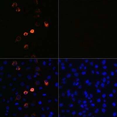 Immunocytochemistry/ Immunofluorescence: SARS-CoV-2 Spike Antibody (ARC2373) - BSA Free [NBP3-07035]