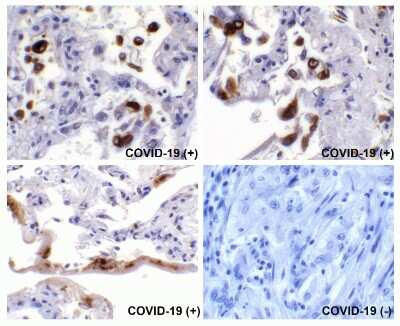 Immunohistochemistry-Paraffin: SARS-CoV-2 Spike Antibody - BSA Free [NBP2-41058]