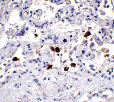 Immunohistochemistry-Paraffin: SARS-CoV-2 Spike Antibody - BSA Free [NBP2-41058]