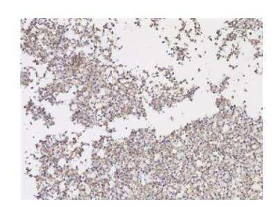 Immunohistochemistry: SARS-CoV-2 Spike RBD Antibody (2165) - Azide and BSA Free [NBP3-07066]