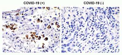 Immunohistochemistry-Paraffin: SARS-CoV-2 Spike S2 Antibody - BSA Free [NBP3-05701]