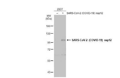 Western Blot: SARS-CoV-2 nsp12 Antibody [NBP3-13457]