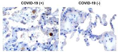 Immunohistochemistry: SARS-CoV-2 nsp13 Antibody - BSA Free [NBP3-07055]