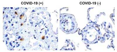 Immunohistochemistry: SARS-CoV-2 nsp14 Antibody - BSA Free [NBP3-07053]