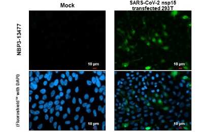 Immunocytochemistry/ Immunofluorescence: SARS-CoV-2 nsp15 Antibody [NBP3-13477]