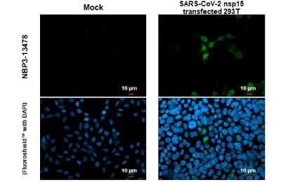 Immunocytochemistry/ Immunofluorescence: SARS-CoV-2 nsp15 Antibody [NBP3-13478]