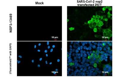 Immunocytochemistry/ Immunofluorescence: SARS-CoV-2 nsp2 Antibody [NBP3-13469]