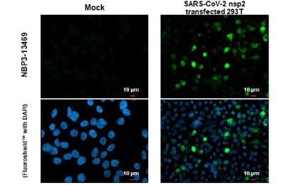 Immunocytochemistry/ Immunofluorescence: SARS-CoV-2 nsp2 Antibody [NBP3-13469]